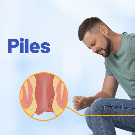 Piles Care